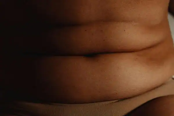 The Hidden Connection: How Stress Shapes Your Fitness and Body Composition 3 image of what stress can do on the stomach area and how Lipo 360 Berkshire can help to change your body shape.